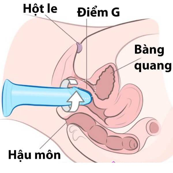 Kỹ thuật xoay và thụt đồng thời 